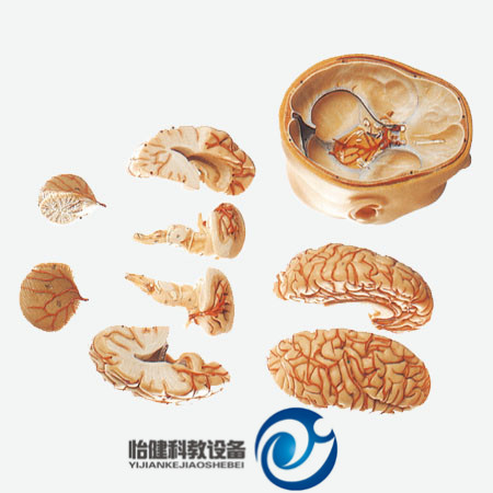 頭部附腦和動(dòng)脈模型