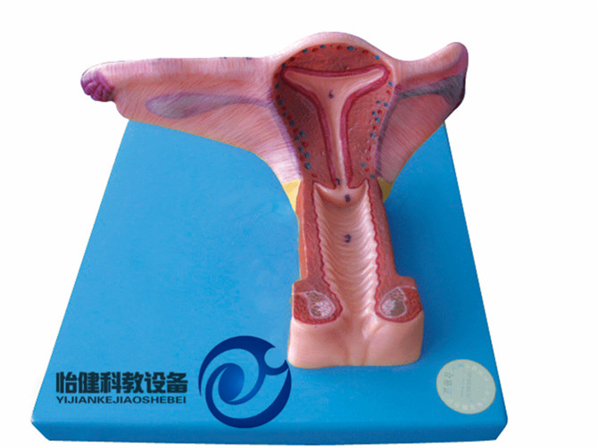 女性內生殖器官模型