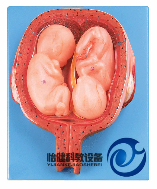 五個月雙胞胎模型
